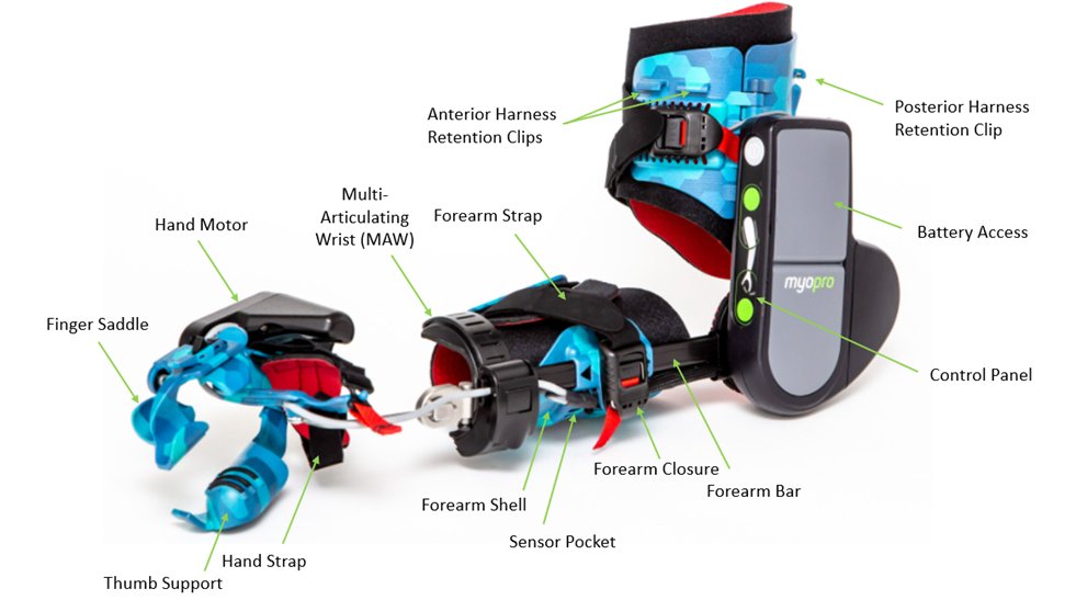 myomoinc's tweet photo. Myomo's products improve arm and hand function for those suffering from upper-limb weakness. #stroke #strokesurvivor #strokeawareness #neuroscience #neurotech #rehabtech #myomo #myopro #PT #OT #OTR https://t.co/tWuUnGDL2e
