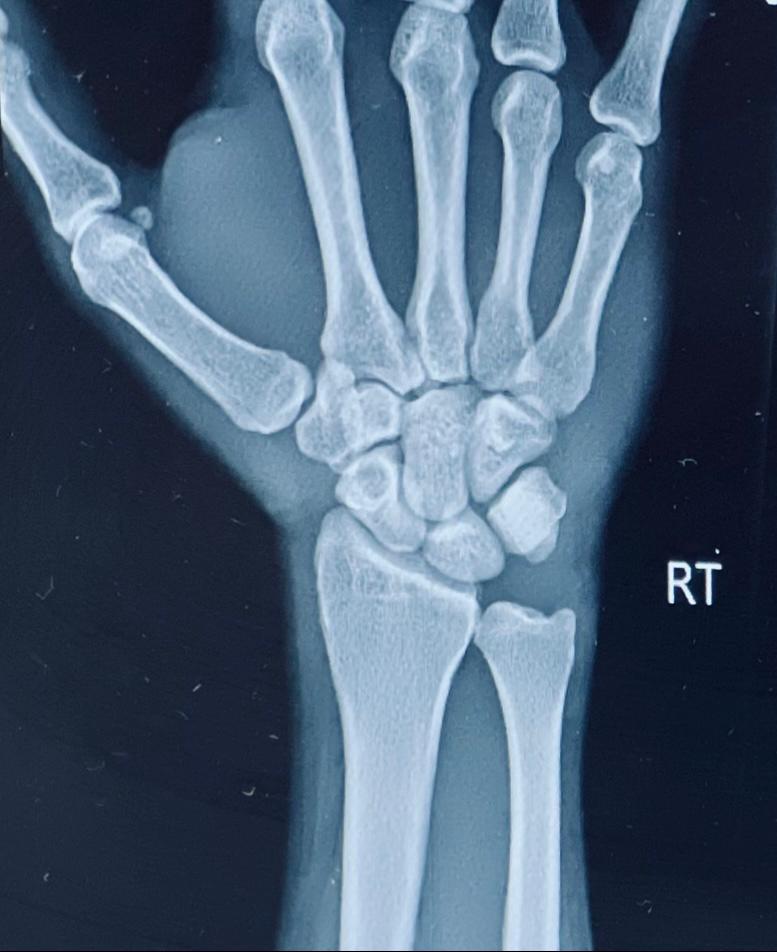 gm

After an involuntary break, I'm BACK. An injury kept me away from typing/writing but it didn't keep me away from collecting.

An 🧵of  some of the artworks I've collected recently.  Give these artists a follow, explore their art and give them a hollar. 

Here we go 👇🏽