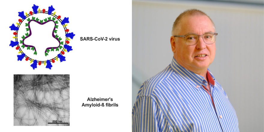 Nat Milton, Academic Lead in Biomedical Science <a href="/LeedsTrinity/">Leeds Trinity University</a> has written about 'COVID-19 and dementia, possible links and the need for further research.'

You can read Nat's blog here ⬇️
leedstrinity.ac.uk/blog/blog-post…

#covid19 #dementia #Research #BiomedicalScience