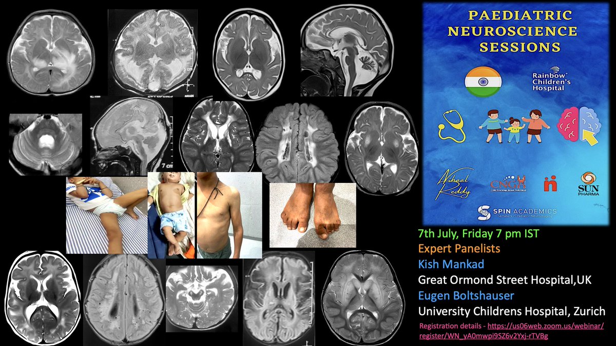 📣 Join us tom evening for  🇮🇳🌈 Paediatric Neuroscience MDT in collaboration with <a href="/spinacademics/">SPIN | Society of Pediatric Neuroimaging</a>! 🧠🌟  Delighted to welcome back gurus <a href="/drmankad/">Dr Kish Mankad</a> &amp; Prof Boltshauser
One-time registration -
us06web.zoom.us/webinar/regist…
#pedsneuro #neurorad
#pedsneuro
Holistic learning 🙏💡