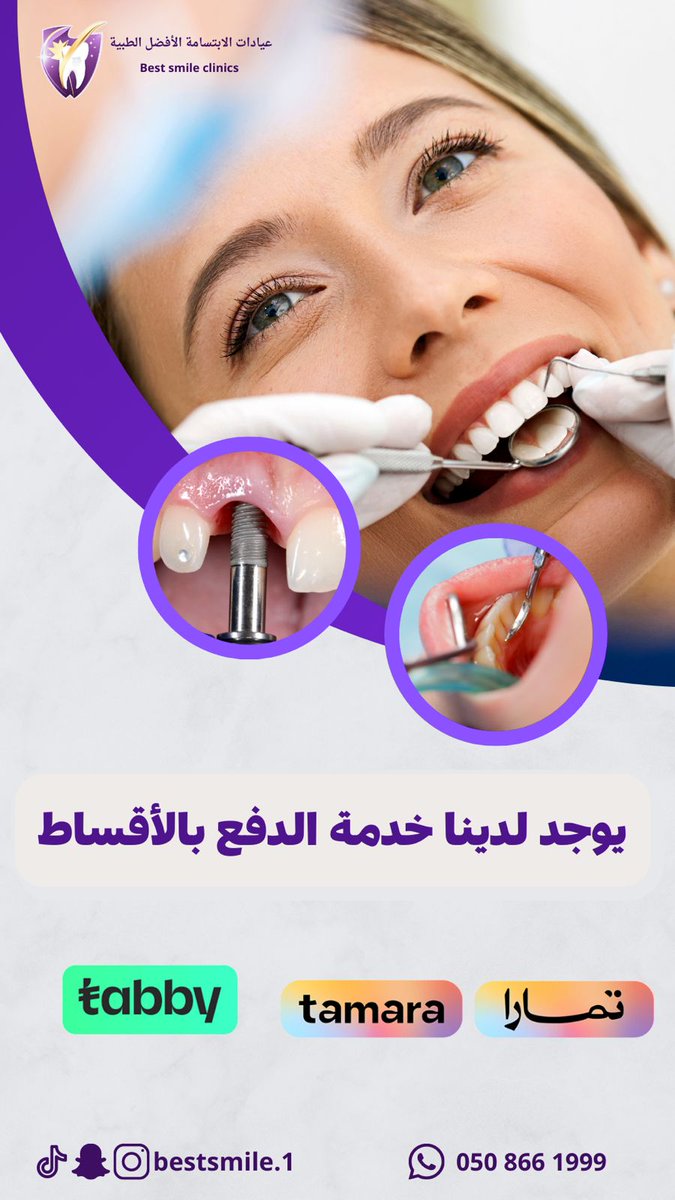 🦷🤩
#المزاحمية #اسنان #عيادات #ضرما_المزاحمية #اسنان #تمارا #تابي #الدفع