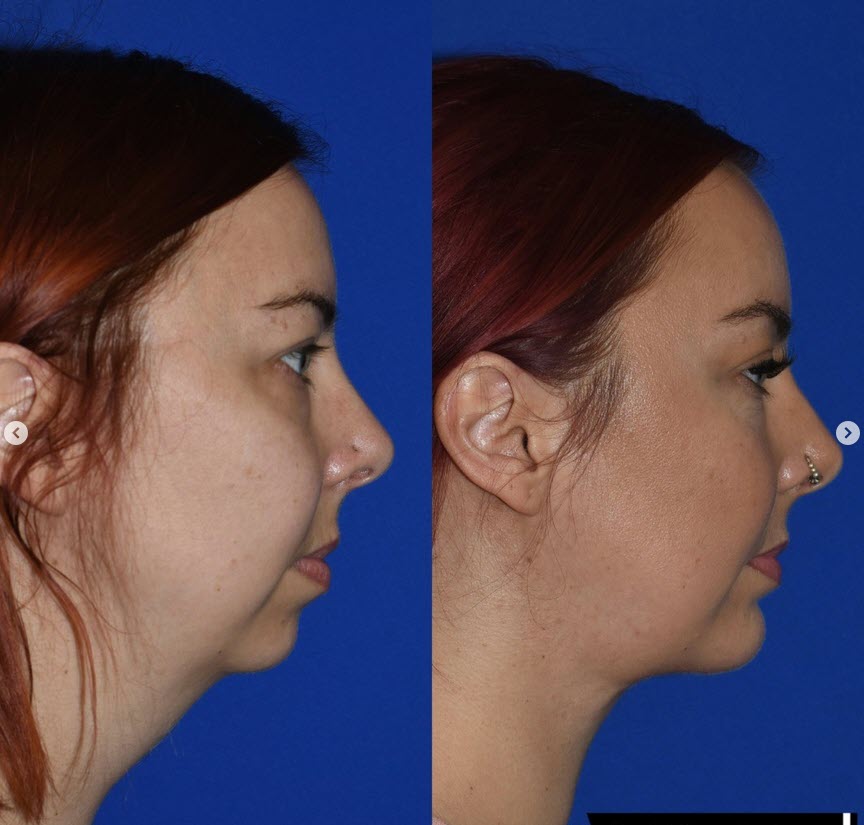 The Portland Center for Facial Plastic Surgery tweet media