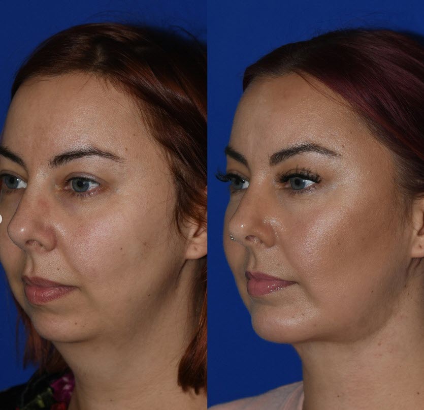 The Portland Center for Facial Plastic Surgery tweet media