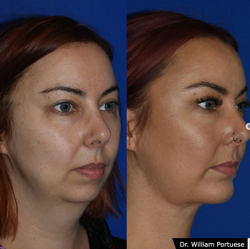 The Portland Center for Facial Plastic Surgery tweet media