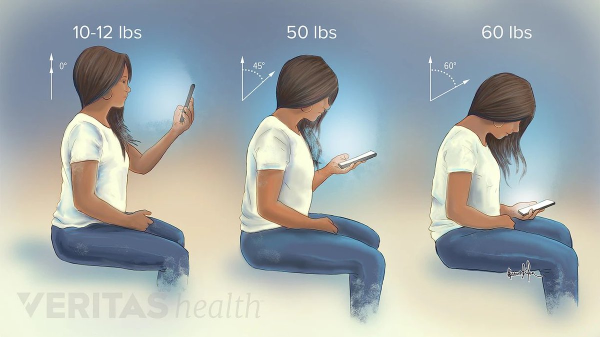 mexicosportsdoc's tweet photo. ¿Tuitear y dolor de cuello?

El dolor cervical o “text neck” se asocia a una mala postura mientras usamos el celular.
Aquí un amable recordatorio para evitar este problema:

✅Sosten tu dispositivo a la altura de los ojos. 🗣️🤳
❌Recuerda no inclinar el cuello para ver videos, textear o scrolear.