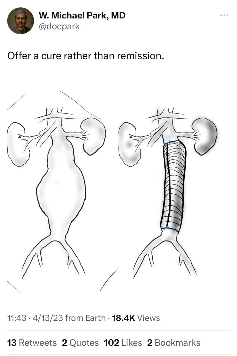 <a href="/canuc_57/">Greg Hayes</a> <a href="/RKTvascular/">Prof Ramesh K Tripathi</a> <a href="/docpark/">W. Michael Park, MD</a> <a href="/farkomd/">frank arko</a> <a href="/westleyohman/">Westley Ohman</a> <a href="/AorticCenter/">Aortic Center</a> Lots of likes and retweets on this opinion. I think we shouldn’t be telling patients this. It’s hyperbole to win a debate about open VS endo repair, but all aortic patients have a lifelong disease that needs management and proper followup.