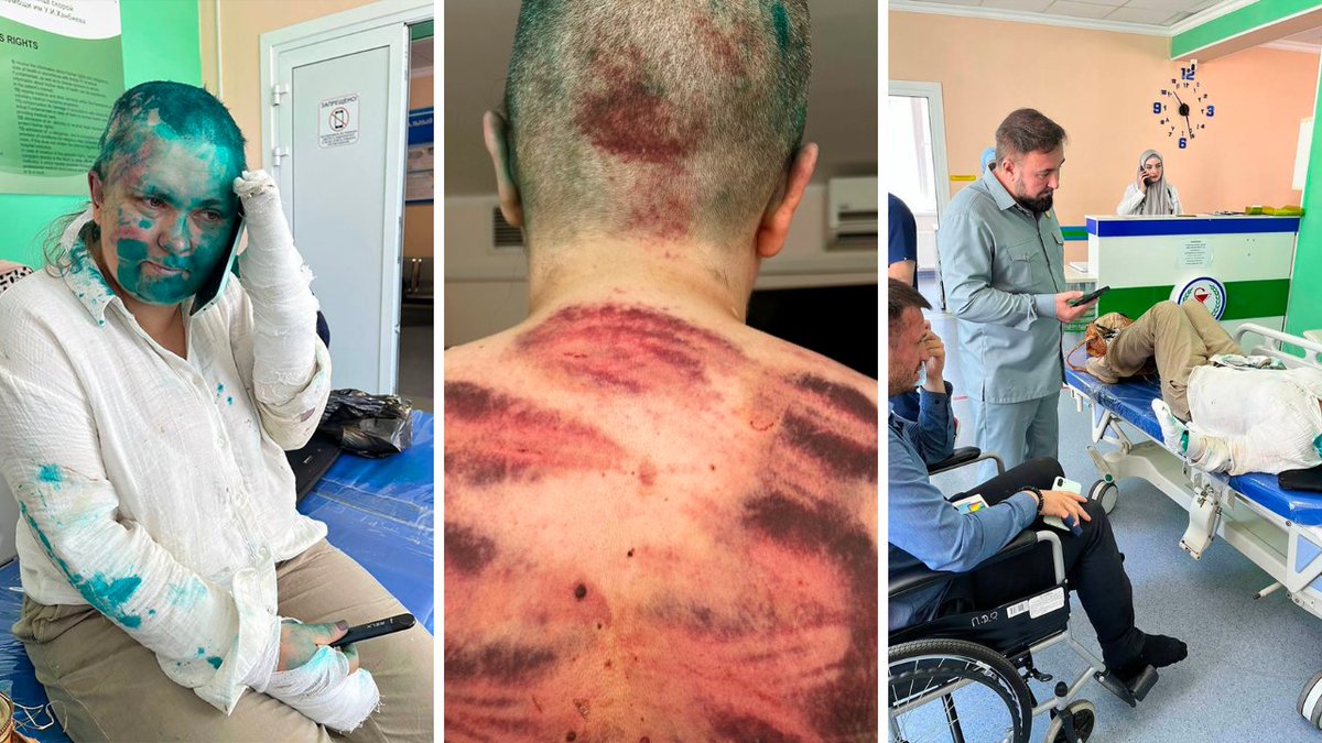 khodorkovsky_en's tweet photo. Couple of day ago, armed thugs attacked a journalist and a lawyer in Chechnya. In a normal country this would be followed by an investigation, arrests, trials, prison terms for those responsible. 

In Russia, especially Chechnya, none of this will happen

Here’s why 🧵 https://t.co/T2C6ikJtiI