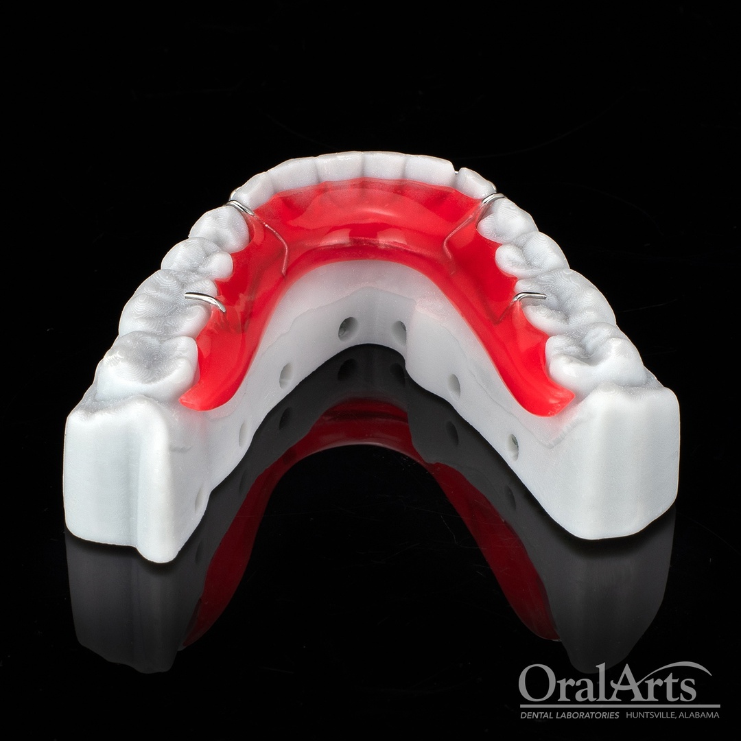 OralArtsDental's tweet image. Check out this beautiful red Hawley #Retainer! Our ortho team has the skills to give your patients a unique retainer they will love &amp;amp; be happy to wear. #Dental