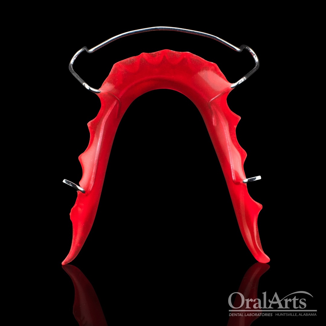 OralArtsDental's tweet image. Check out this beautiful red Hawley #Retainer! Our ortho team has the skills to give your patients a unique retainer they will love &amp;amp; be happy to wear. #Dental