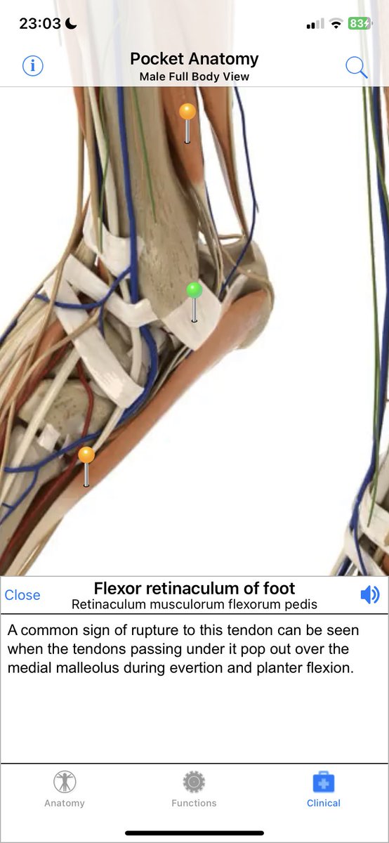 Doing some studying but.. I was just the other day thinking ‘pretty sure these tendons aren’t supposed to run óver my malleolus.’ Wednesday should be fun (and will try to capture them in (well or out more like) situ.