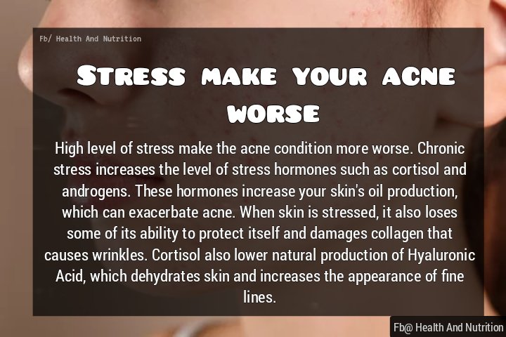 Nutrition_1M's tweet photo. Manage your stress levels !!!
.
.
.
.
.
#stress #acne #acnescars #acnebreakouts #skin #skinhealth #pimples #acnesolution #acnetreatment #cortisol #skincare https://t.co/SllRN7GHL4
