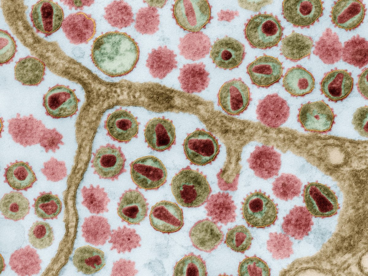 A clinical trial in Botswana shows that broadly neutralizing antibodies may help suppress the #HIV reservoir in children after antiretroviral therapy, offering a proof-of-concept for #BnAB therapies for pediatric groups. <a href="/YuLabAtRagon/">Yu & Lichterfeld Labs @ Ragon</a> <a href="/AidsHarvard/">Botswana Harvard Health Partnership</a> scim.ag/3ga