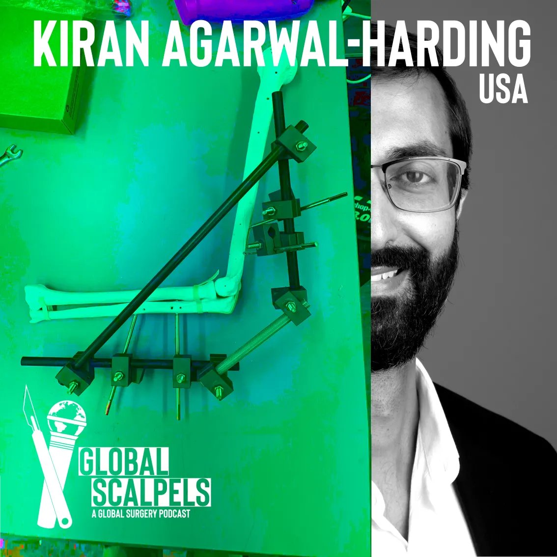 Global Scalpels: A Global Surgery Podcast (@globalscalpels) on Twitter photo We're excited to release our latest episode featuring <a href="/KiranHarding/">Kiran Agarwal-Harding</a>, discussing:
π₯ Developing affordable medical devices
π Creating a non-profit start-up
π Ethical aspects of research in low-income countries
@BIDMC <a href="/OrthoGlobal/">Harvard Global Orthopaedics Collaborative</a> @HarvardOrtho We're excited to release our latest episode featuring <a href="/KiranHarding/">Kiran Agarwal-Harding</a>, discussing:
π₯ Developing affordable medical devices
π Creating a non-profit start-up
π Ethical aspects of research in low-income countries
@BIDMC <a href="/OrthoGlobal/">Harvard Global Orthopaedics Collaborative</a> @HarvardOrtho