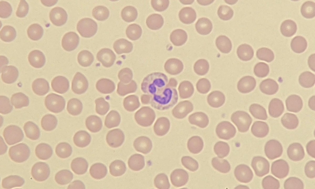 #FilmFriday

Before coffee.     vs     After coffee. 

It's that time of the week.

#OnlyCells #neutrophilsareamood