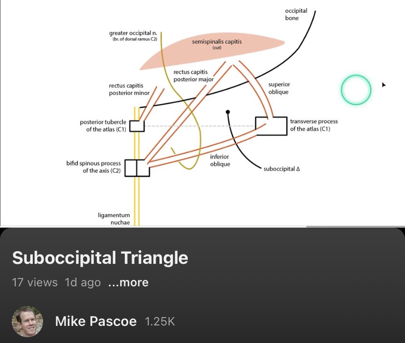 мιĸe paѕcoe (@mpascoe) on Twitter photo Students of <a href="/CUPhysTher/">CU Physical Therapy</a> requested a narrated video of a Suboccipital Triangle drawing. Was able to get this one on YouTube pretty quickly 👇
youtu.be/AnPKaU6fl8o Students of <a href="/CUPhysTher/">CU Physical Therapy</a> requested a narrated video of a Suboccipital Triangle drawing. Was able to get this one on YouTube pretty quickly 👇
youtu.be/AnPKaU6fl8o