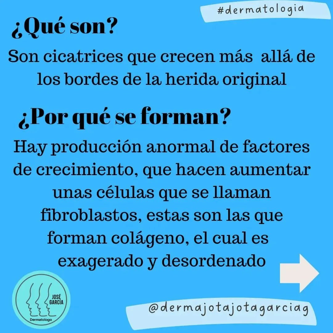 Dermajojotagar1's tweet photo. Los queloides son cicatrices exageradas que pueden generar además de dolor, molestias cosméticas por eso requieren tratamiento. 
Aquí una breve descripción de esta patología
#dermatologia #piel #queloides #dermatologosmedellín
#dermatologoscolombia https://t.co/nsa1MAS3Cc