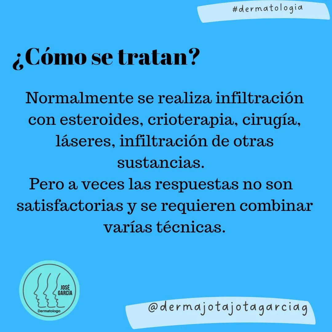 Dermajojotagar1's tweet photo. Los queloides son cicatrices exageradas que pueden generar además de dolor, molestias cosméticas por eso requieren tratamiento. 
Aquí una breve descripción de esta patología
#dermatologia #piel #queloides #dermatologosmedellín
#dermatologoscolombia https://t.co/nsa1MAS3Cc