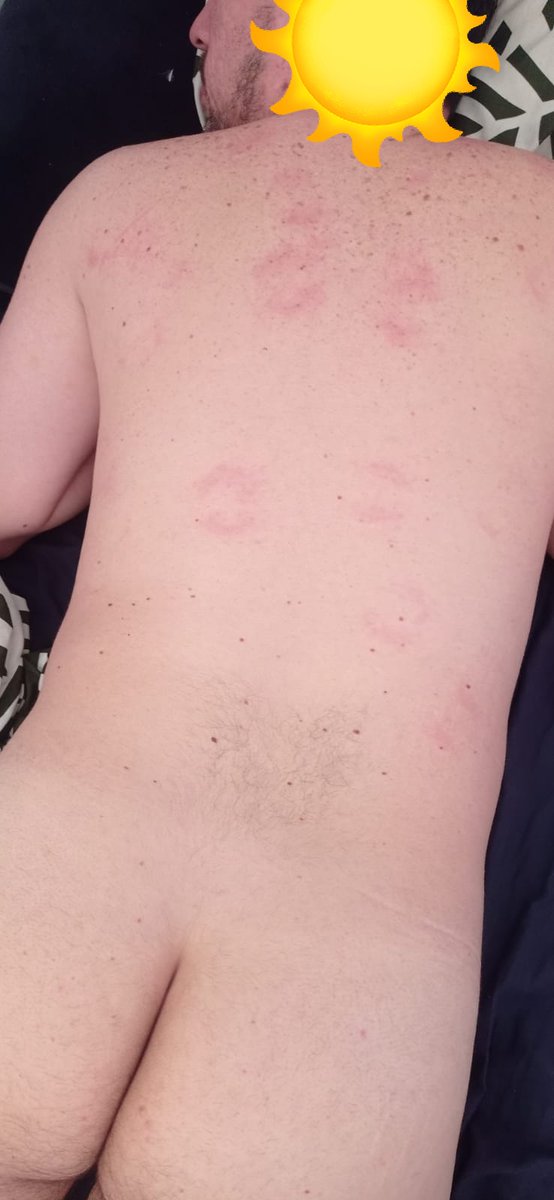 She signed my back 😋 / ella me firmó la espalda 😋