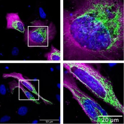 FocalPlane (@focalplane_jcs) on Twitter photo Happy #FluorescenceFriday! This week we’re highlighting the effect of overproduction of aggregation-prone Tau on mitochondria from <a href="/hopeneeds/">Hope Isobel Needs</a> Kevin Wilkinson, Jeremy Henley & <a href="/IanofBristol/">Ian Collinson</a> <a href="/LabCollinson/">Collinson Lab</a> <a href="/BristolBiochem/">Bristol Biochemistry</a>.
journals.biologists.com/jcs/article/13…
#microscopy #cellbiology #OpenAccess Happy #FluorescenceFriday! This week we’re highlighting the effect of overproduction of aggregation-prone Tau on mitochondria from <a href="/hopeneeds/">Hope Isobel Needs</a> Kevin Wilkinson, Jeremy Henley & <a href="/IanofBristol/">Ian Collinson</a> <a href="/LabCollinson/">Collinson Lab</a> <a href="/BristolBiochem/">Bristol Biochemistry</a>.
journals.biologists.com/jcs/article/13…
#microscopy #cellbiology #OpenAccess