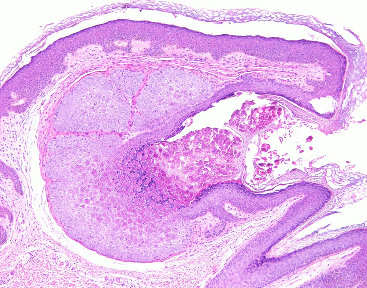 Esther Adler, MD tweet media