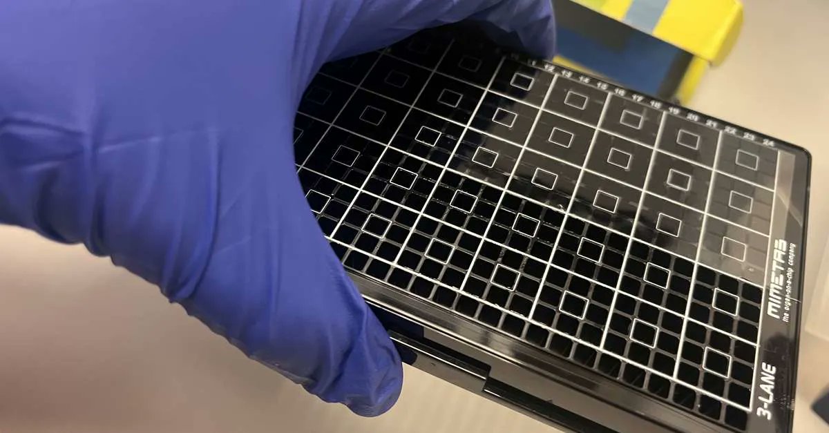 A placenta on a chip developed at <a href="/UoDMedicine/">UoD Medicine</a> has the potential to transform research into life-threatening conditions in pregnancy, such as #preeclampsia.

Read more about this ground-breaking work 👉 buff.ly/3rwNtKK 

@colinemurdoch <a href="/MIMETAS_3D/">MIMETAS</a>