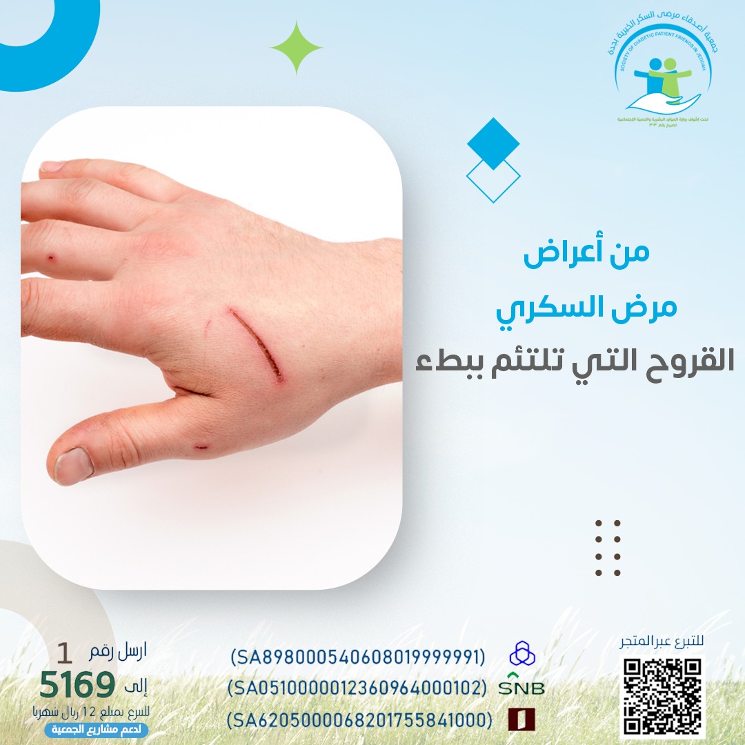 Diabfriendsj's tweet photo. احذر فمن أعراض الأصابة بداء السكري هي صعوبه التئام القروح والجروح .
#صحتك_تهمنا https://t.co/lXddYxDfDj