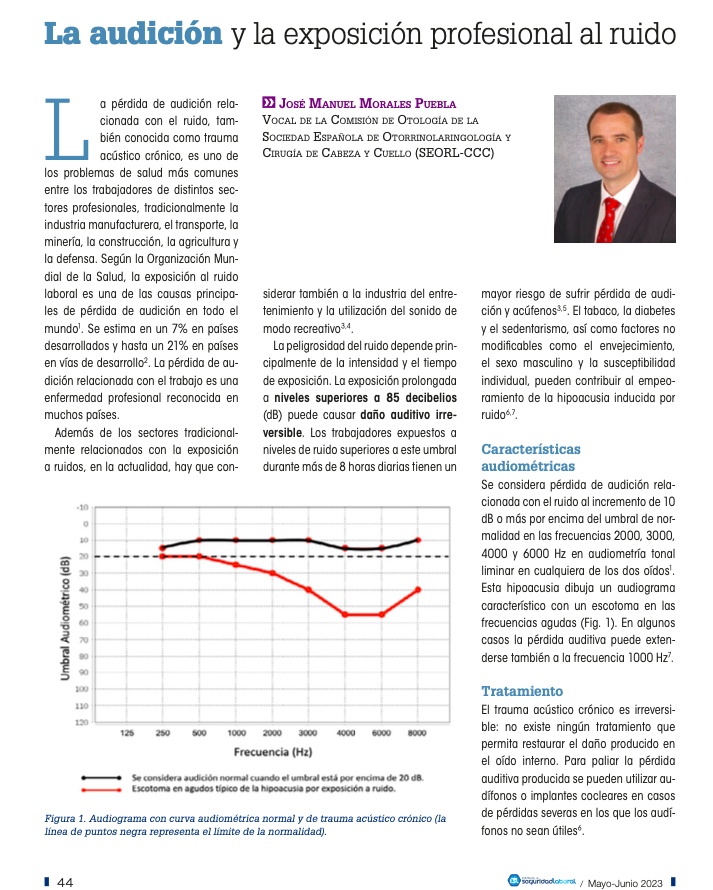 SEORLCCC's tweet photo. “Los trabajadores expuestos a más de 85 decibelios durante más de 8 horas tienen un mayor riesgo de sufrir pérdida de audición y acúfenos”, explica el doctor José Manuel Morales Puebla, vocal de la comisión de Otología de la @SEORLCCC Vía @Revista_FSL
https://t.co/1xwkcFBqJl https://t.co/CFDjh3e0or