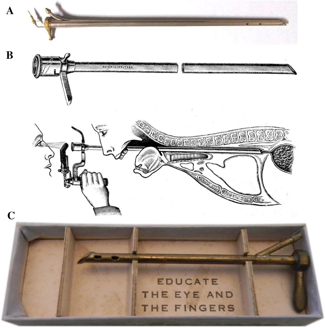 Shahin Ayazi (@sayazi) on Twitter photo July 14th is the #endoscope day! Dr. Chevalier Jackson from #Pittsburgh developed the endoscope at <a href="/AHNtoday/">AHN</a> #WestPenn hospital in 1890.
Read more about his life in our recent paper from <a href="/AHNSurgeryInst/">AHN Surgery Institute</a> and <a href="/AHNesophagus/">AHN Esophageal Institute</a> in <a href="/SurgEndosc/">Surgical Endoscopy</a>:
link.springer.com/article/10.100…
He is the father July 14th is the #endoscope day! Dr. Chevalier Jackson from #Pittsburgh developed the endoscope at <a href="/AHNtoday/">AHN</a> #WestPenn hospital in 1890.
Read more about his life in our recent paper from <a href="/AHNSurgeryInst/">AHN Surgery Institute</a> and <a href="/AHNesophagus/">AHN Esophageal Institute</a> in <a href="/SurgEndosc/">Surgical Endoscopy</a>:
link.springer.com/article/10.100…
He is the father