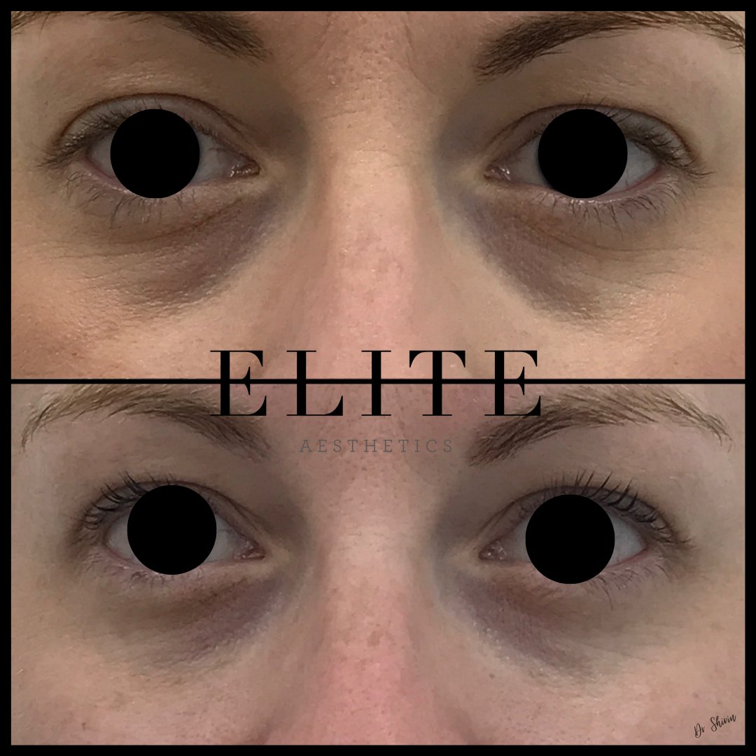 Elite Aesthetics tweet media