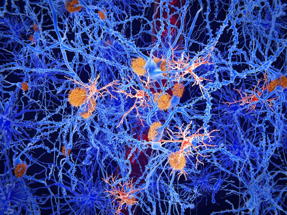 UKDRI's tweet photo. We're delighted to announce the latest awardees of our Pilot Studies programme - designed to encourage UK DRI ECRs to consider new &amp; innovative avenues of dementia research &amp; take the next step towards independence👏 🎉 🙌 🧠 

Check out all 8 projects👉https://t.co/FywQvT9f5X https://t.co/ugROf9MqsI