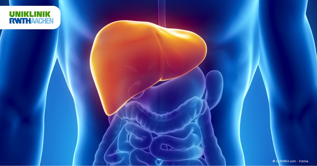 UniklinikAachen's tweet image. #Statine könnten eine entscheidende Rolle bei der Vorbeugung von #Lebererkrankungen spielen. Das zeigt eine im @JAMANetwork erschienene #Studie, die ein Team der Medizinischen Klinik III an der @UniklinikAachen durchgeführt hat. bitly.ws/KHPM
