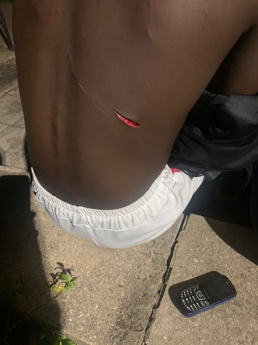 malehallsgh's tweet photo. These are degree students for christ sake. The University of Ghana VC has failed as a woman. IGP Dampare should put his shs boys in order.
We shall take the world back to KNUST 2018. #RestoreMaleHalls #SayNoToSuicide #SayNoToPoliceBrutality #ActionDey #FCFriday https://t.co/N0CbiqQ8nE