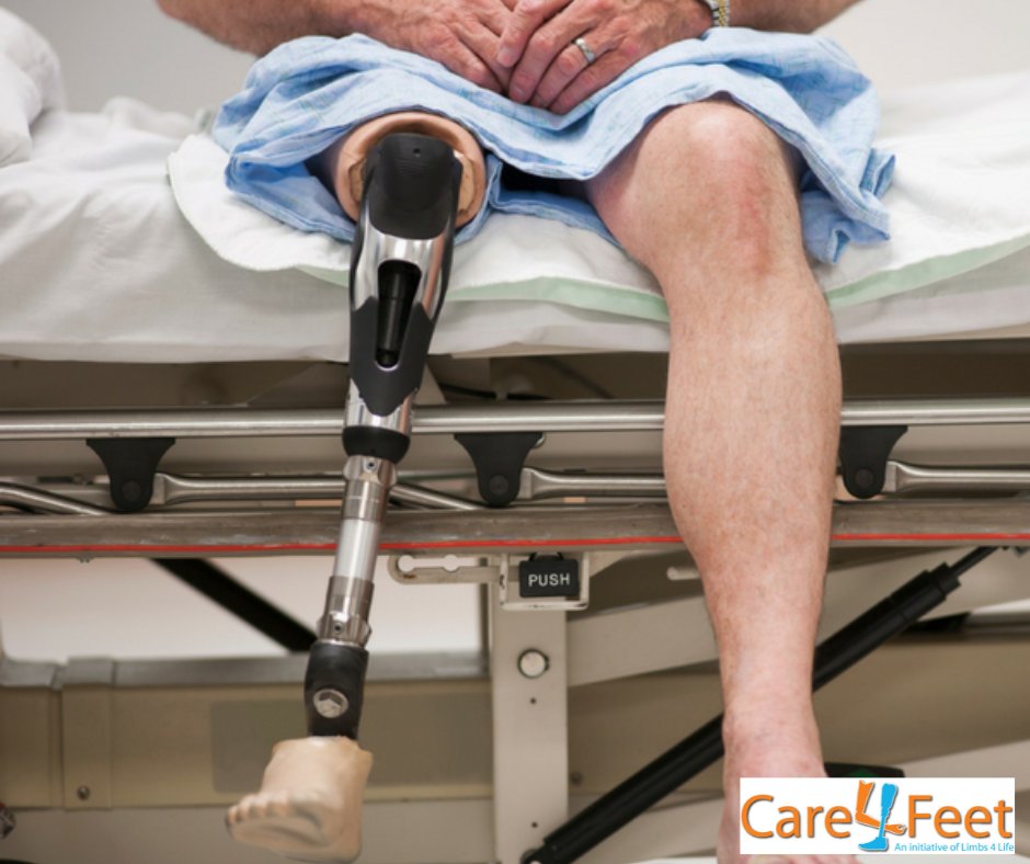 Limbs4LifeInc's tweet photo. Looking after your feet can prevent further
problems and complications, even amputation. Take
our quiz today! Find out how you can care for your feet
and avoid problems in the future - https://t.co/zxqg8bwniK
#footcare #podiatry #preventamputation
#diabetes #diabetescare https://t.co/LAQn1zbpv1