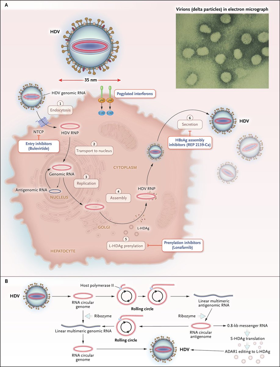 infeccHRUmalaga's tweet photo. En @NEJM revisión🤓📚 #HepatitisD, la hepatitis viral más #SEVERA aunq precisa #coinfeccion VHB🦠🫱🏻🫲🏻🦠. Mayor riesgo #cirrosis y #Cahepatocular con coinfeccion q monoinfección VHB. Tratamiento: Interferón pero nuevas moléculas: #Bulevirtide ya aprobadas
https://t.co/gdJgG0GdEs https://t.co/7OA8SYjflA