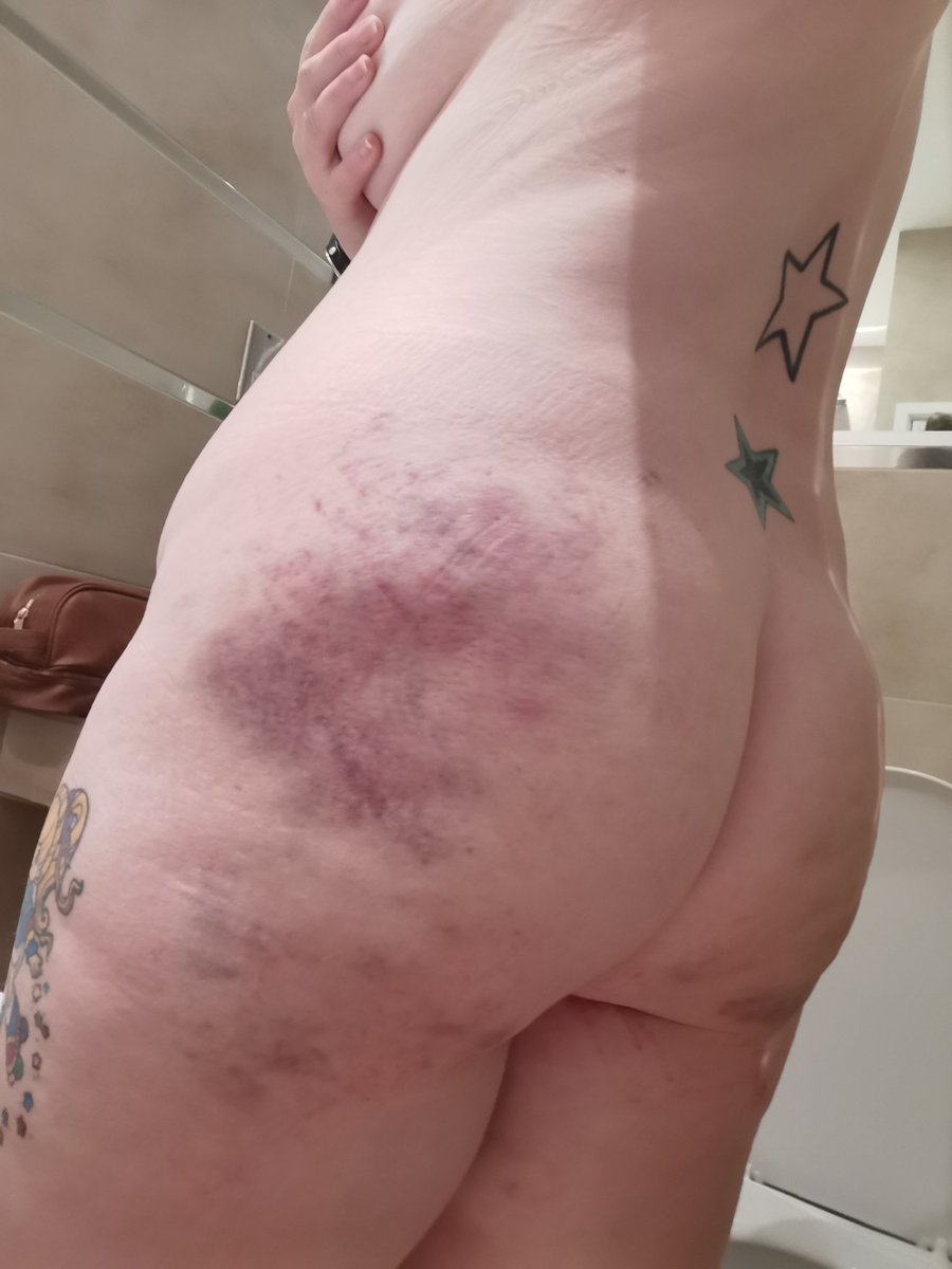 bootiful_kay's tweet photo. Oh wozers!
#OF #onlyfans #thiccgirl #thickthighs #bigbutt #bigbooty #brusies #bdsm #spanking #ittokitwell #newvideocoming #followme #subscribetoday #noPPV @onlyfans https://t.co/4Z6dber3DC