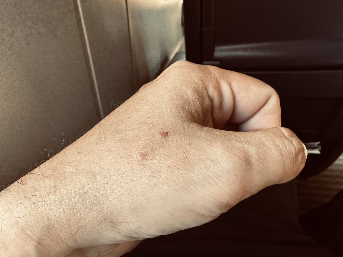 achimh's tweet photo. Got a NFC implant and since I don‘t know better I just made it to be a @poapxyz dispender. Happy to give out some of my POAPs at the @ALLINNFT77 event tomorrow and from now on for the rest of the year. 🍌 https://t.co/7hzPIjxo4i