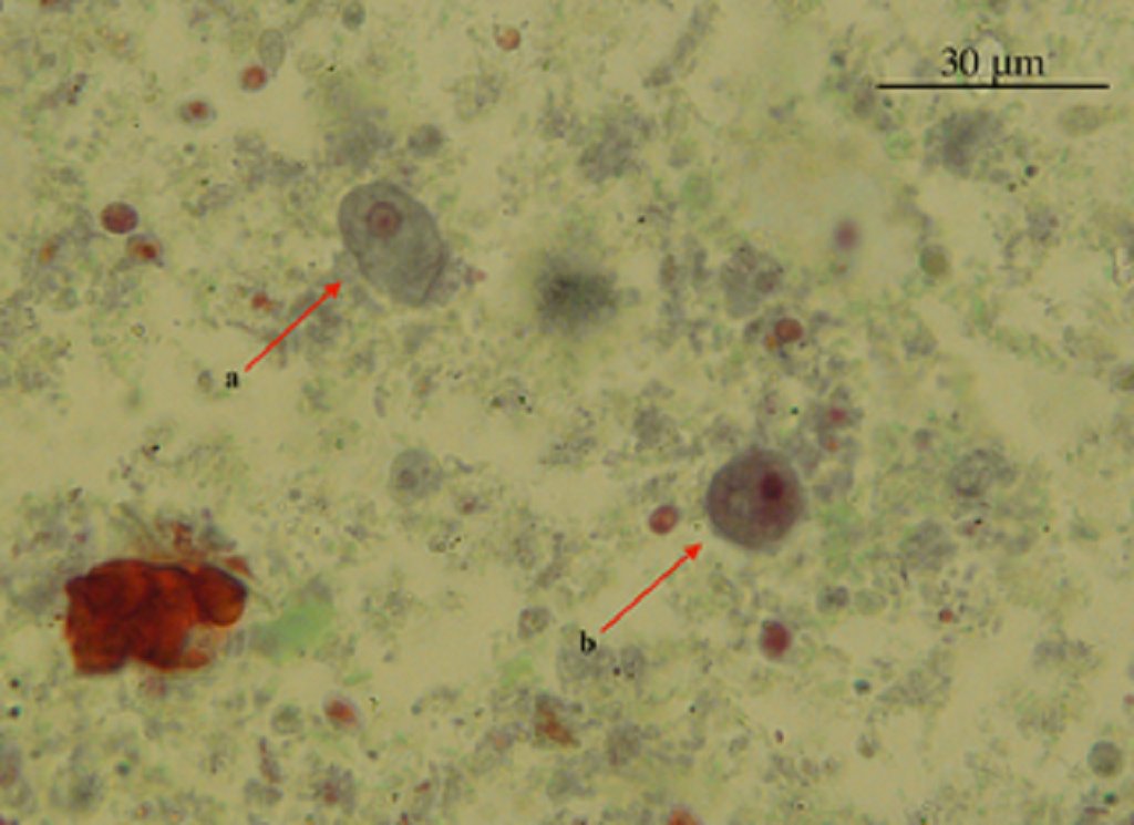 down2earthindia's tweet photo. Diarrhoea-causing pathogen becoming prevalent in Kolkata, prevention & control strategies needed: Study
story by @rohinikrish9
https://t.co/bxvgQ0J7kf
#Diarrhoea #Entamoeba #Kolkata #health #disease https://t.co/DqyadhhiaI