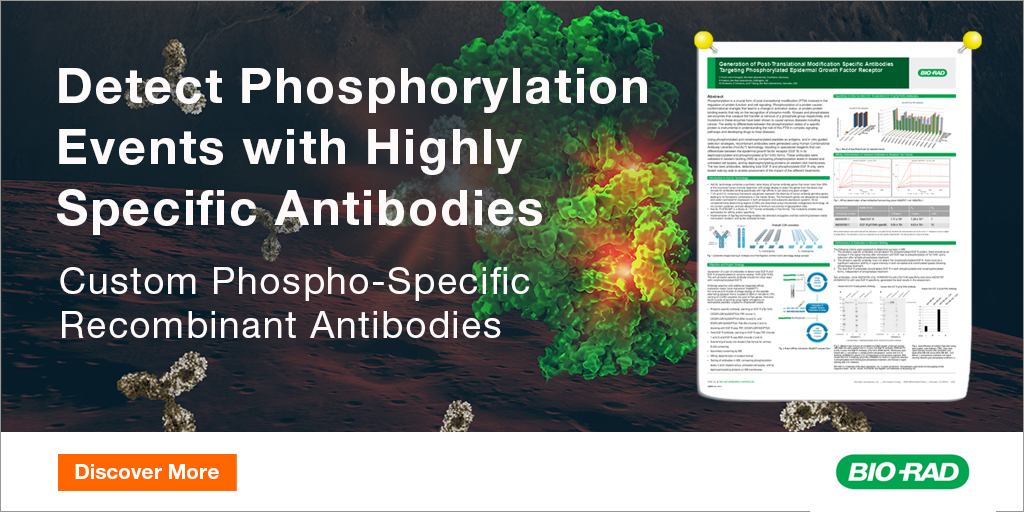 BioRadFlowAbs's tweet photo. Download our poster describing how the HuCAL® antibody library and phage display technology were used to develop highly specific, anti-human EGF R and anti-human EGF R pTyr1045 antibodies for #WesternBlotting: https://t.co/G1TSfhnGGz
#CustomAbs #Signaling https://t.co/b7g8zyGKeI