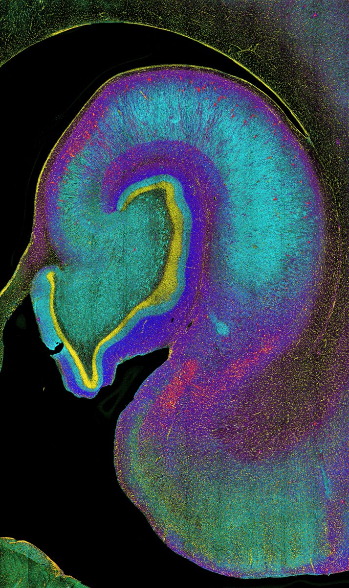 DaniBeckman's tweet photo. Is hippocampus day again?!🙈Happy #FluorescenceFriday! @zeiss_micro #neuroscience
#hippocampusfans https://t.co/HNCw5fOoFe