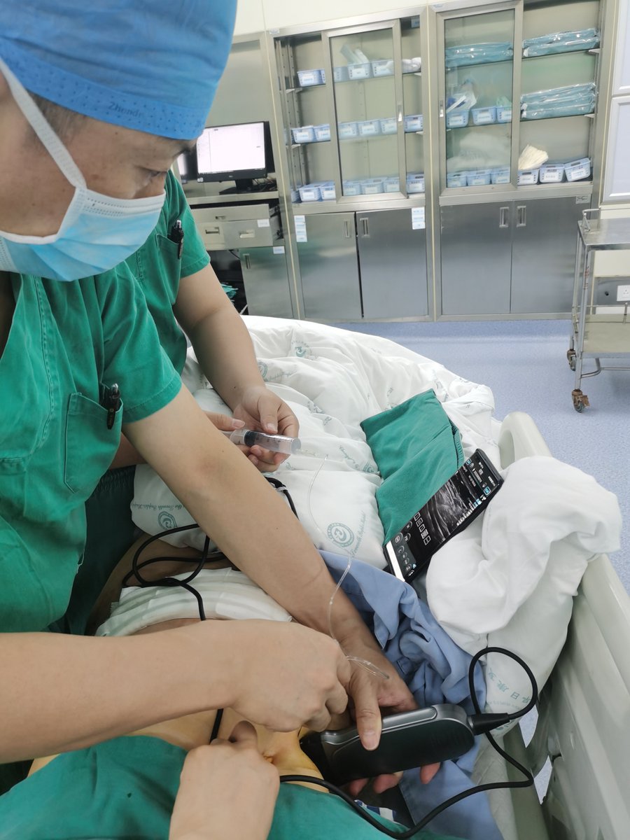 A picture of an anesthesiologist utilizing the CHISON handheld ultrasound device, #SonoEye, in his daily practice.

#anaesthesia #ultrasoundimaging
