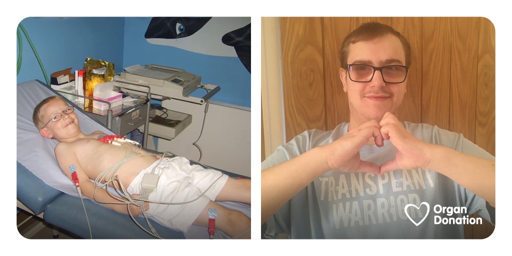 NHSOrganDonor's tweet photo. Connor was born with congenital heart disease and after multiple surgeries, he was given just days to live.

Thanks to the generosity of a donor and their family, Connor received a heart transplant aged 3. It's beating strong 20 years later.

Read more ➡️ https://t.co/aNGeomFst4 https://t.co/P4WFmRGNRa
