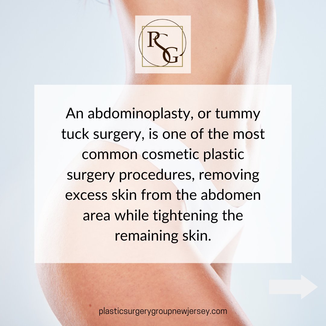 PSG_NJ's tweet image. Get the body of your dreams with a drainless, painless Tummy Tuck 

Head over to plasticsurgerygroupnewjersey.com to schedule a personal consultation with one of our board-certified plastic surgeons

#PSGnj #transformation #tummytuck #mommymakeover #theplasticsurgerygroup