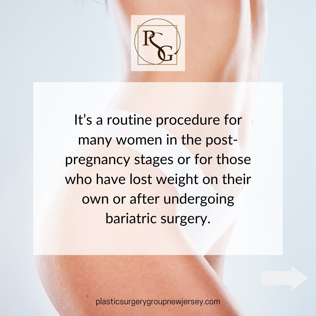 PSG_NJ's tweet image. Get the body of your dreams with a drainless, painless Tummy Tuck 

Head over to plasticsurgerygroupnewjersey.com to schedule a personal consultation with one of our board-certified plastic surgeons

#PSGnj #transformation #tummytuck #mommymakeover #theplasticsurgerygroup