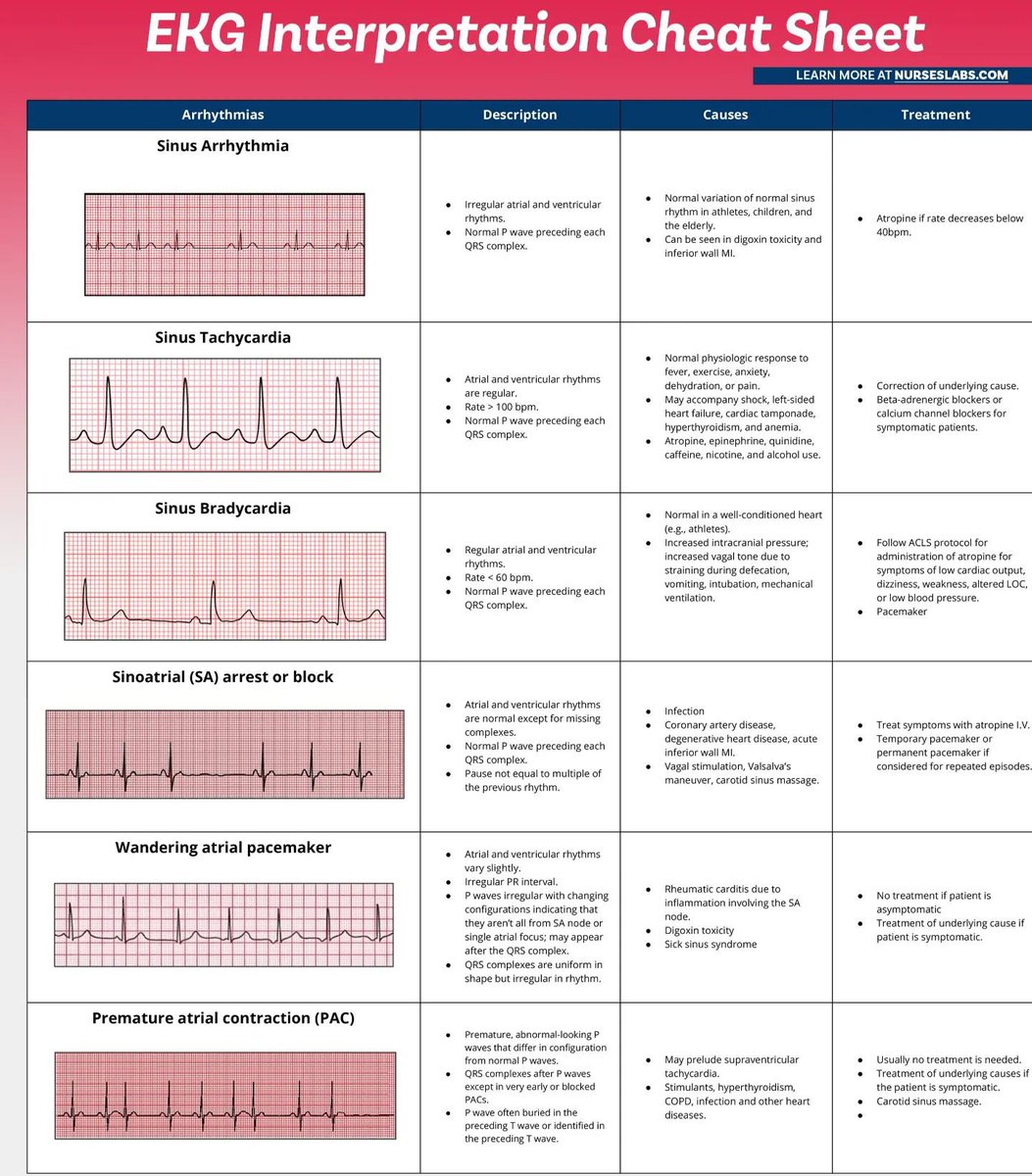 TA_ECG's tweet photo. EKG Interpretation Cheat Sheet https://t.co/YvzNn06lXx