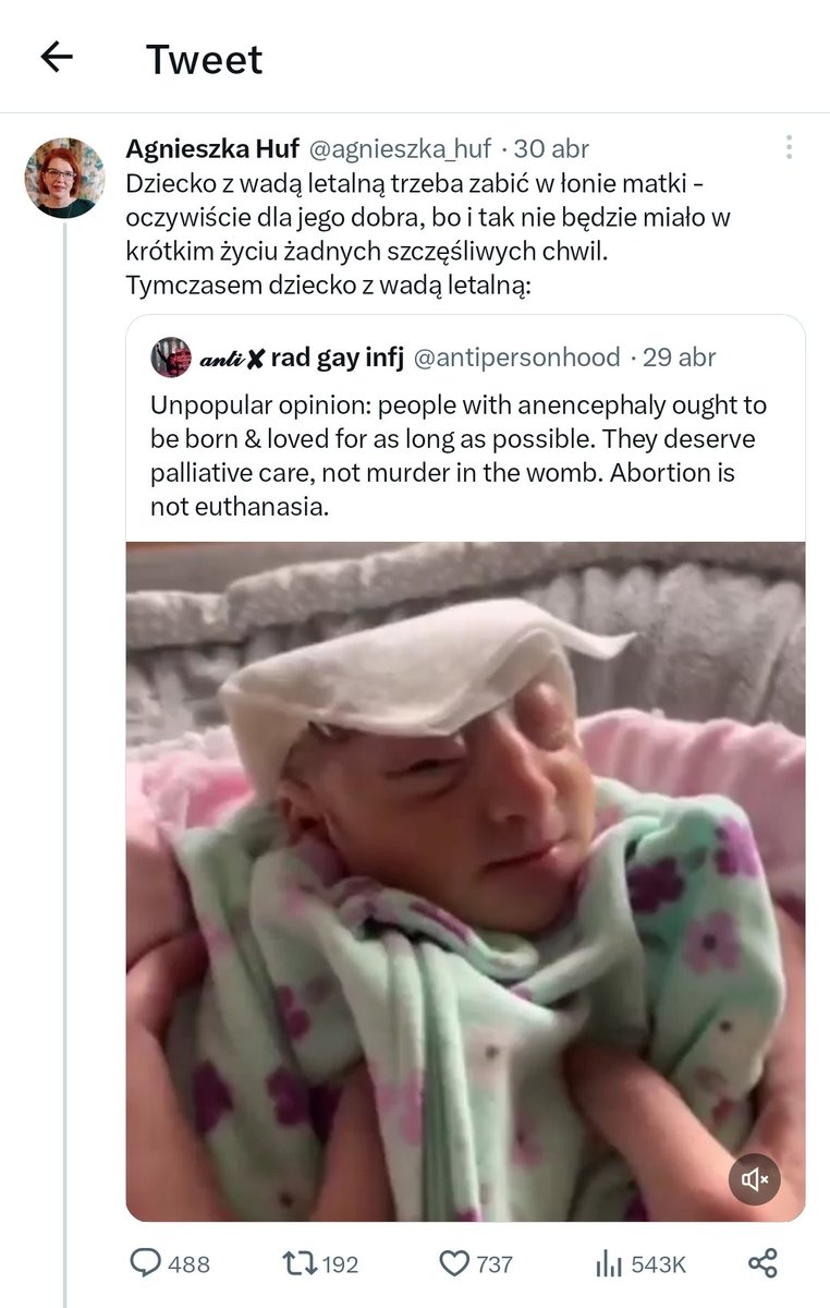 Bezmózgi (z zalążkiem tyłomózgowia) płód który z trudnością ogarnia oddychanie i cykl pracy serca nie jest zdolny do odczuwania czegokolwiek - nie ma przodomózgowia ani móżdżku.
To jak kura biegająca bez głowy po podwórku. 
Sadyzm w czystej postaci. 
x.com/agnieszka_huf/…