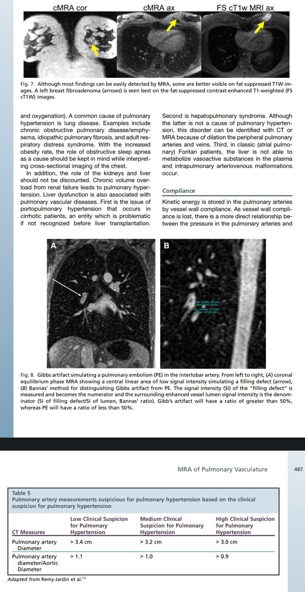 Magnetic Resonance Angiography of Pulmonary Vascukature.
doi.org/10.1016/j.mric…
🫁🎞🎥💡📚
<a href="/theclinic/">theclinic</a> <a href="/ERSpublications/">ERS publications</a> <a href="/atscommunity/">American Thoracic Society (ATS)</a> <a href="/ALATorax/">ALAT</a> <a href="/SeparRespira/">SeparRespira</a> <a href="/NeumoMadrid/">Neumomadrid</a> @neumopararesis <a href="/socapnet/">SOCAP 🫁</a> <a href="/SPLF_SocPneumo/">Société de Pneumologie de Langue Française (SPLF)</a> <a href="/pneumosbpt/">Sociedade Brasileira de Pneumologia e Tisiologia</a> @DGPneumologie <a href="/young_dgp/">YoungDGP</a>