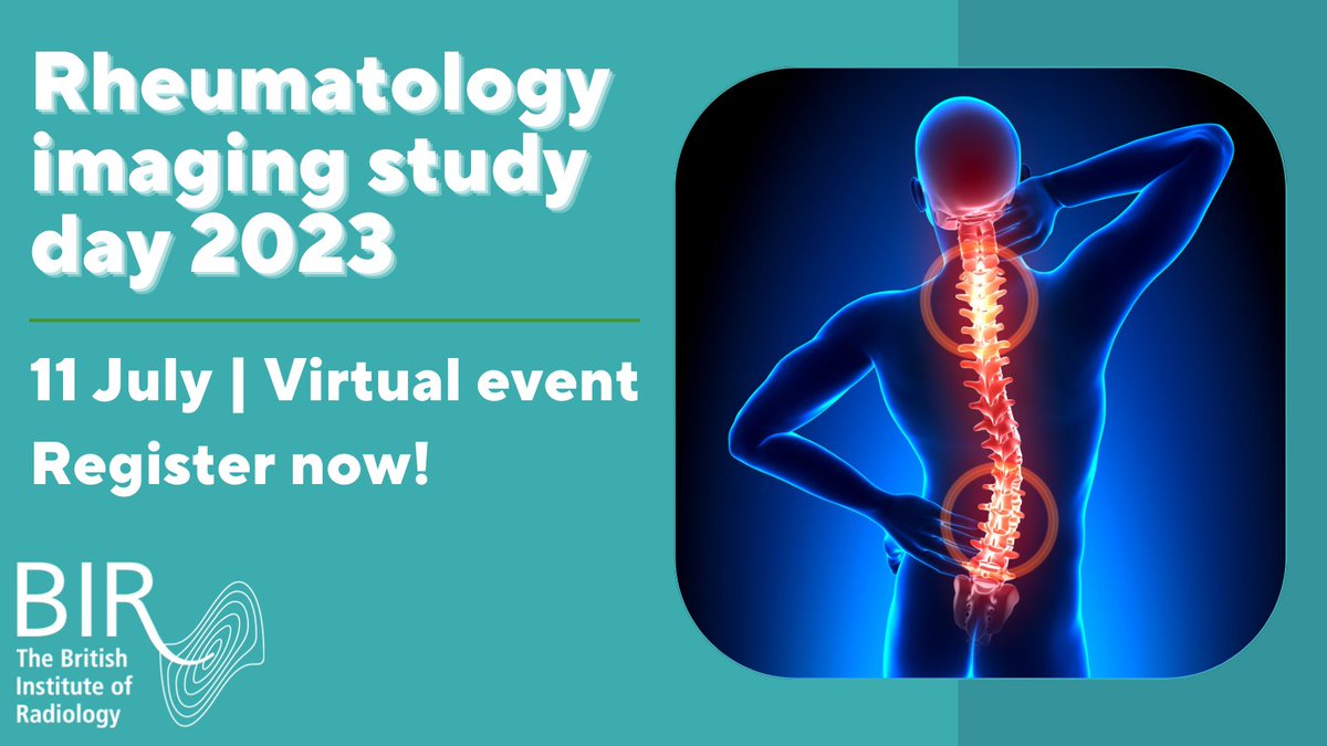 BIR (@bir_news) on Twitter photo Two days left to register for our Rheumatology imaging study day, where we will be covering common rheumatological imaging challenges faced by the specialist and non-specialist reporting radiologists! Find out more here: bit.ly/RISD23 <a href="/BIR_CI_SIG/">BIR Clinical Imaging Special Interest Group</a> Two days left to register for our Rheumatology imaging study day, where we will be covering common rheumatological imaging challenges faced by the specialist and non-specialist reporting radiologists! Find out more here: bit.ly/RISD23 <a href="/BIR_CI_SIG/">BIR Clinical Imaging Special Interest Group</a>