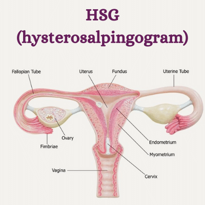 aurawomen's tweet photo. HSG test: Diagnostic procedure for women. Checks uterus and fallopian tubes. Dye injected, X-rays used. Detects fertility issues. Takes 15-30 minutes, mild discomfort possible.
Read for more info: https://t.co/FrWRovVEnu

#aurawomen #aura #hsgtest #hsg #fertility https://t.co/ci3xl2d7Nl