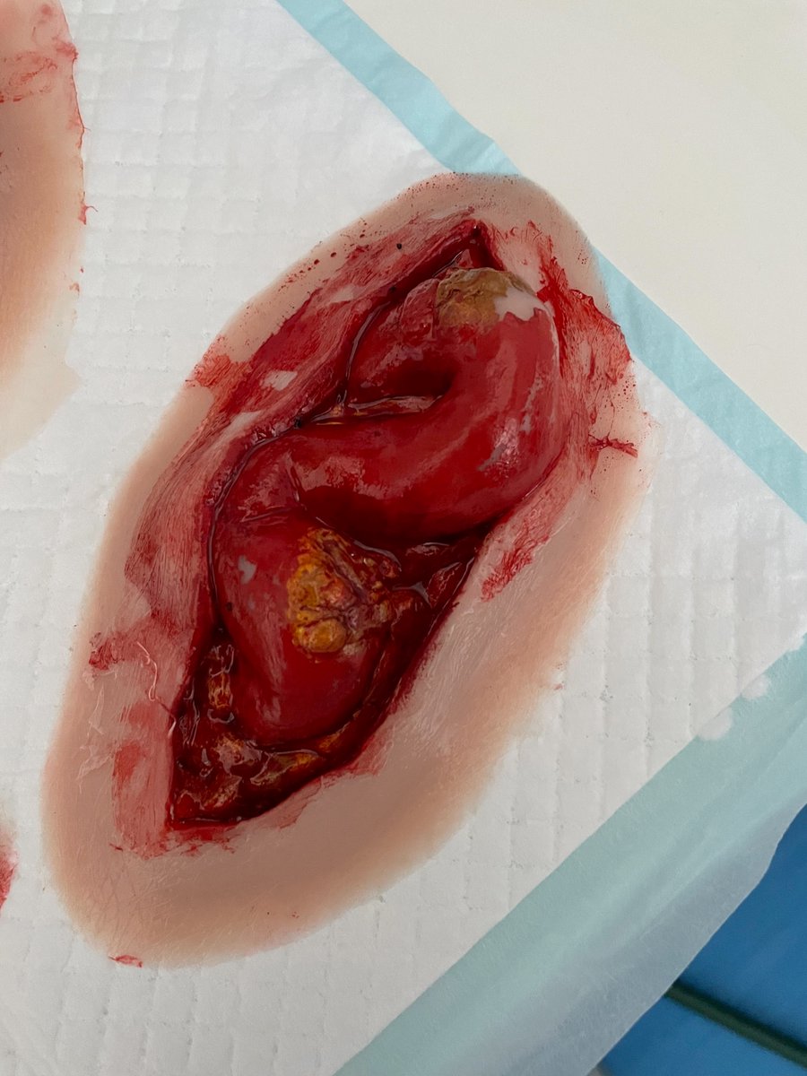 UoG_GLASCSim's tweet photo. In the recent Mass Casualty Simulation, our talented #GLASC Sim Techs used Moulage to enhance the realism of injuries and wounds on simulated patients and manikins.
@sharonmweldon
@ProfDerekMoore
@janeharri1966
@BeverlyJoshua2 https://t.co/FlABj0Mf1J