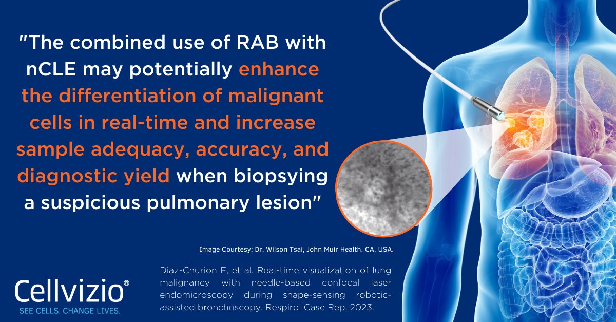 Cellvizio® by Mauna Kea Technologies on Twitter: